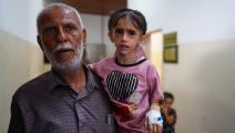 طفلة فلسطينية مريضة رفقة والدها بمستشفى خانيونس، 24 يونيو(فرانس برس)