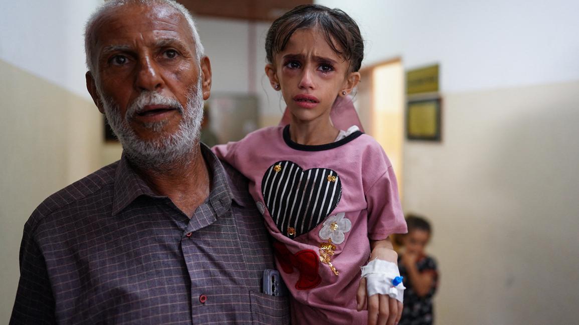 طفلة فلسطينية تعاني من سوء التغذية (بشار طالب/ Getty)