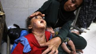 تنتشر الأمراض الجلدية وغيرها في غزة (أشرف أبو عمرة/ الأناضول)