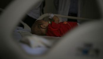 طفل مصاب بالتهاب الكبد (خوانشو توريس/ الأناضول)