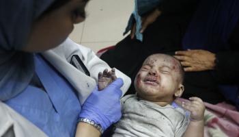 طفل فلسطيني مصاب في حرب إسرائيل على غزة - مستشفى شهداء الأقصى في دير البلح وسط قطاع غزة - 13 يونيو 2024 (أشرف أبو عمرو/ الأناضول)