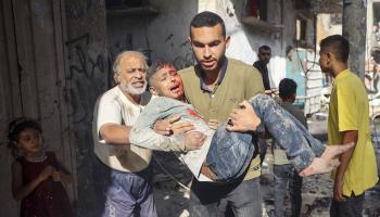طفل جريح جراء القصف الإسرائيلي المستمر (إياد البابا/ فرانس برس)