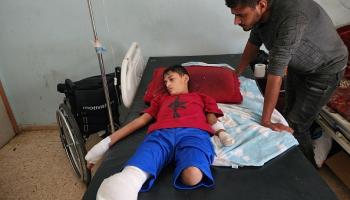 صبي فلسطيني فقد أطرافه جراء هجمات إسرائيلية، 3 يونيو 2024 (الأناضول)