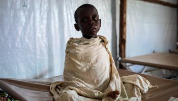 طفل مصاب بالملاريا في أوغندا - مجتمع