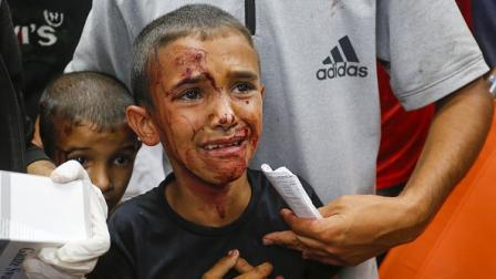طفل جريح في وسط قطاع غزة جراء غارات إسرائيلية، 4 يونيو 2024 (Getty)